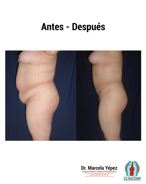 Ci_Ob_Perfil1-3