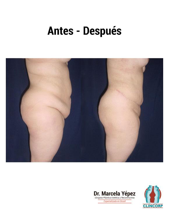 Ci_Ob_Perfil4-2