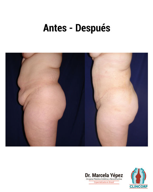 Ci_Ob_Perfil_Izquierdo2-3