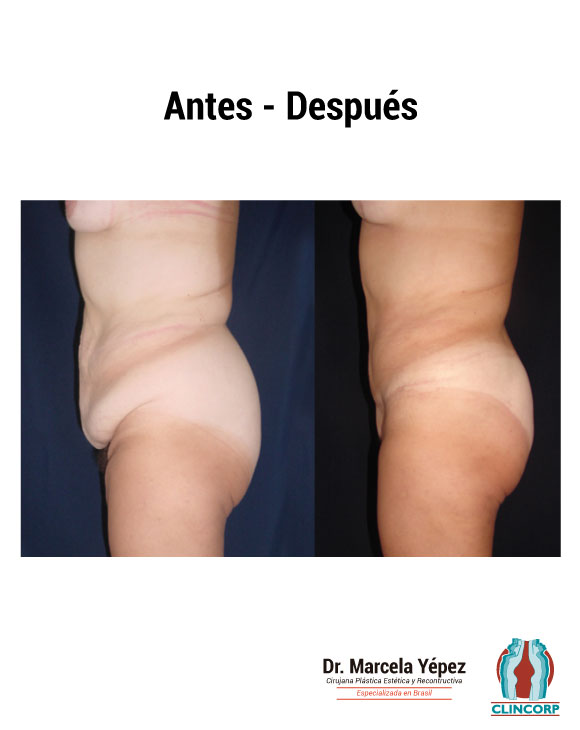 Ci_Ob_Perfil_Izquierdo3-3