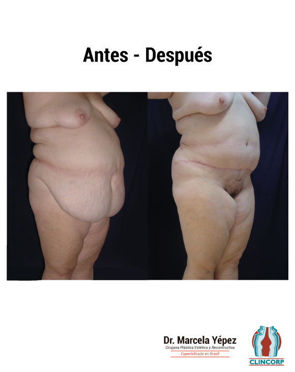 caso5_fototres